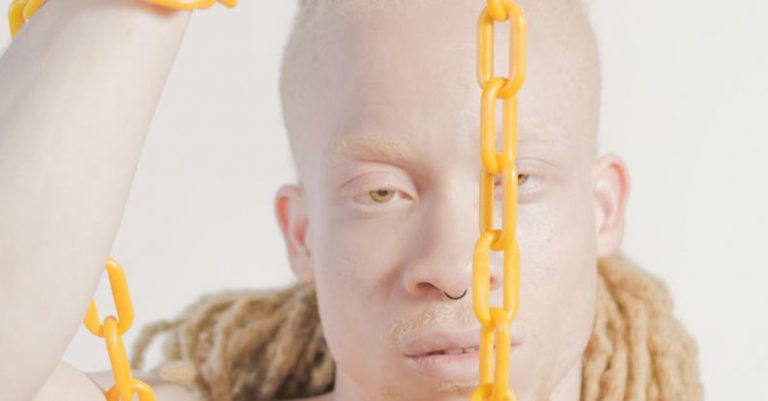 Skin - Topless Man Holding Yellow Chain