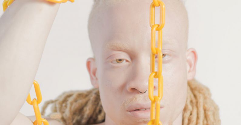 Skin - Topless Man Holding Yellow Chain